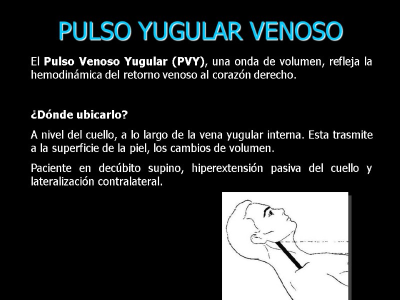 El Pulso Venoso Yugular (PVY), una onda de volumen, refleja la hemodinámica del retorno